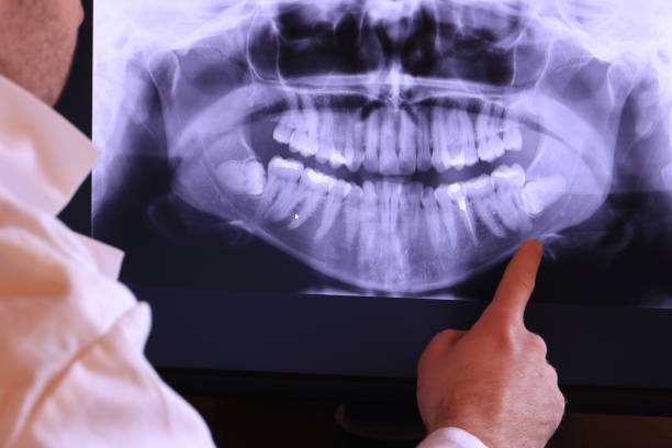Best Emergency Dentist for Lost Fillings or Crowns in Clarendon Hls, IL