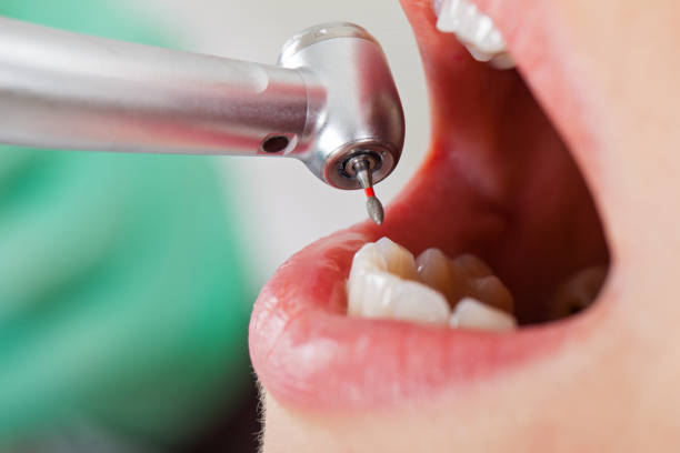 Best Broken or Cracked Tooth Emergency Dentist in Clarendon Hls, IL